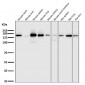 Anti-Integrin alpha 2 ITGA2 Rabbit Monoclonal Antibody